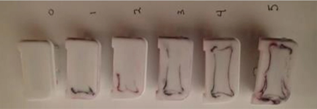 Figure 4: Stress cracking in molded polycarbonate buttons after exposure to sunscreen. (Sequence of increasing molded in stress caused by process induced stress in buttons).